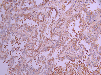 PPP2R5E Antibody