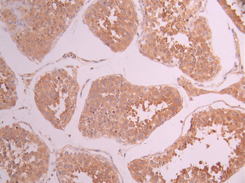 PPP2R5E Antibody