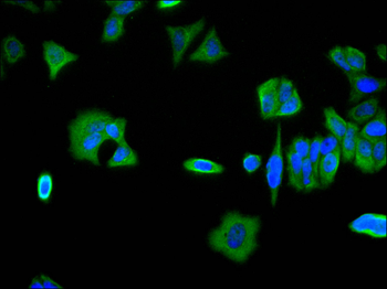 CSDE1 Antibody