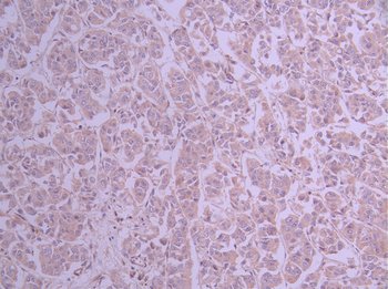 DYNLT1 Antibody