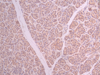 DYNLT1 Antibody
