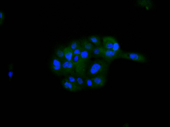 DYNLT1 Antibody
