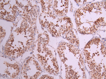 POLB Antibody