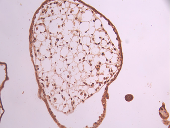 NR2F1 Antibody