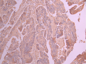ULK3 Antibody