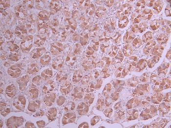 ULK3 Antibody
