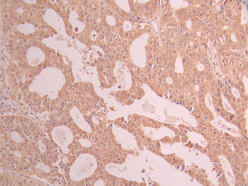 GABARAP Antibody