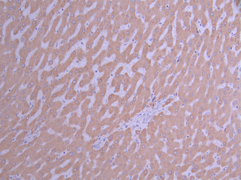 CYP2D6 Antibody