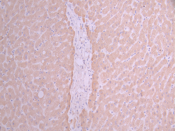 CYP2D6 Antibody