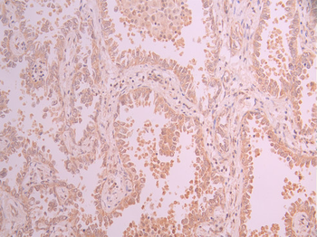 NFKBIE Antibody
