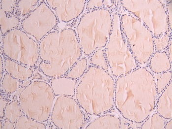 NFKBIE Antibody