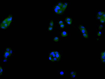 GOT1 Antibody