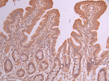 PCK2 Antibody