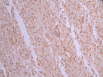 BCL11A Antibody