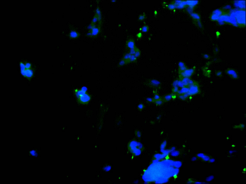 BCL11A Antibody