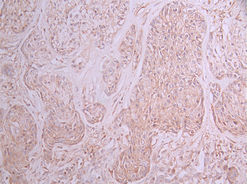IQGAP1 Antibody