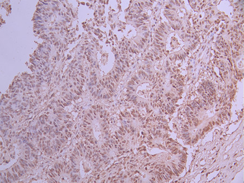 SRSF1 Antibody