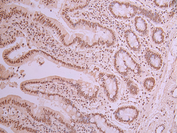 SRSF1 Antibody
