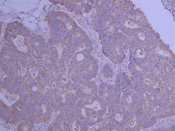 TFAM Antibody
