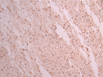 ZEB1 Antibody