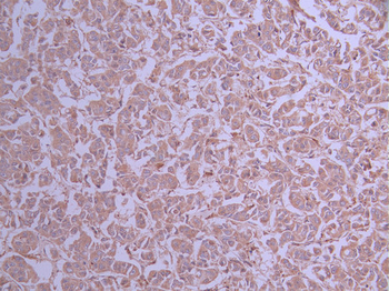 RAPGEF3 Antibody