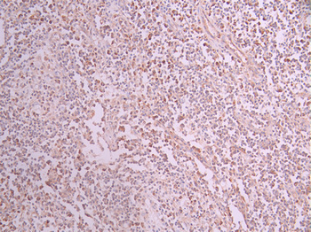 RAPGEF3 Antibody