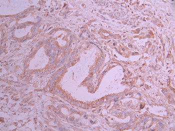 TXNIP Antibody