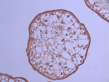 DTL Antibody