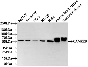 CAMK2G&CAMK2B Antibody