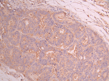 CAMK2G&CAMK2B Antibody