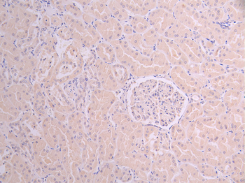 CAMK2G&CAMK2B Antibody