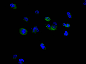 CAMK2G&CAMK2B Antibody