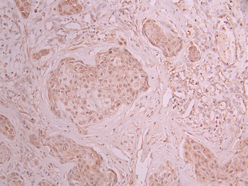 HMGA1 Antibody
