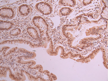 HMGA1 Antibody