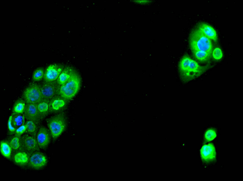 HMGA1 Antibody