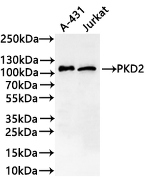PRKD2 Antibody