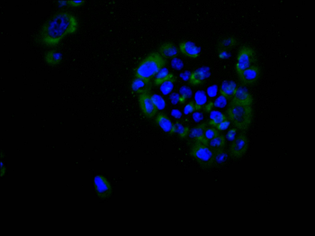 PRKD2 Antibody