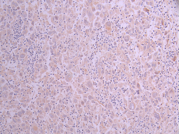 NPC1 Antibody