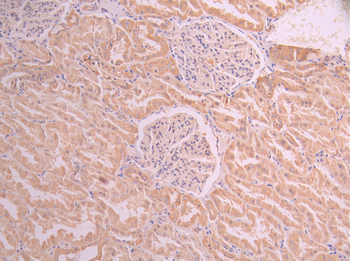 NPC1 Antibody