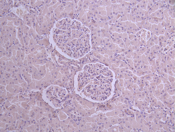 PDCD6IP Antibody