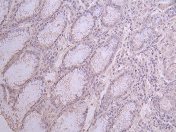 PDCD6IP Antibody