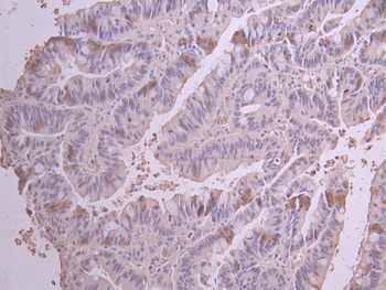 PDCD6IP Antibody