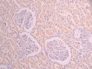 HSPA5 Antibody