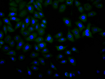DST Antibody