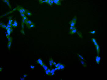 DST Antibody