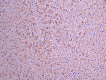 CRP Antibody