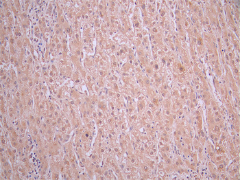 IGF1R Antibody