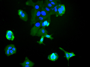 IGF1R Antibody