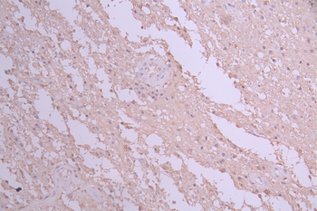 DIABLO Antibody