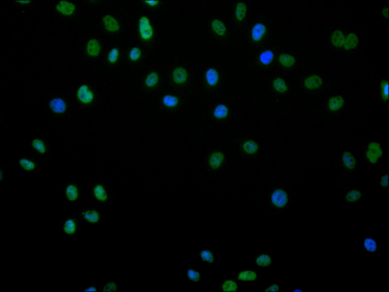 TCF7L2 Antibody
